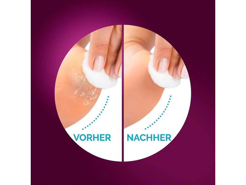 Scholl Hornhautentferner Velvet Smooth Wet &amp; Dry