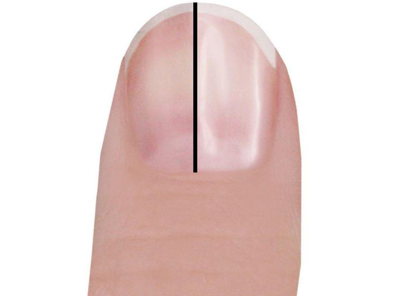 Trisa Perfect Nails Ersatzrollen