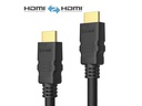 sonero Kabel HDMI - HDMI, 1 m