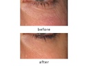 Silk'n Antiaging-Gerät FaceTite Revive Cordless Weiss