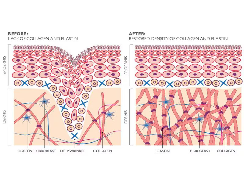 Silk'n Antiaging-Gerät FaceTite Revive Cordless Weiss